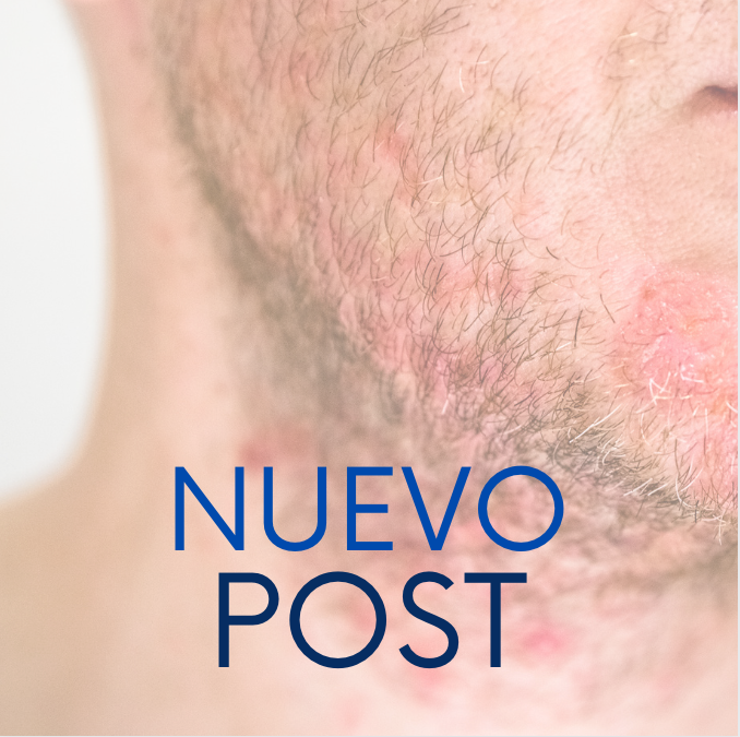 10 razones por las que tu cara puede estar roja