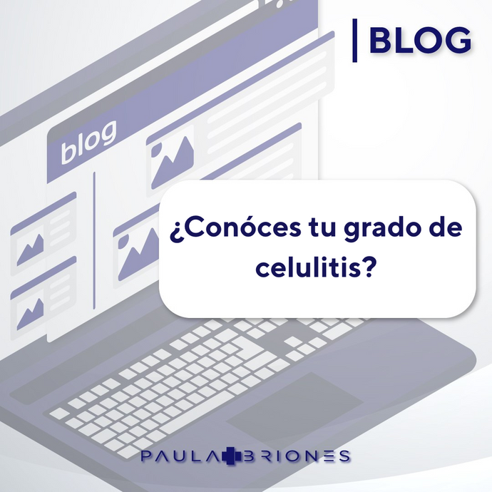 ¿Conoces tu grado de celulitis?